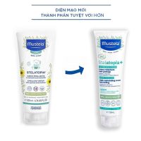 Dưỡng da Mustela 150ml công thức mới đặc biệt dành cho tình trạng da chàm bẩm sinh